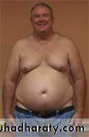 Endocrine