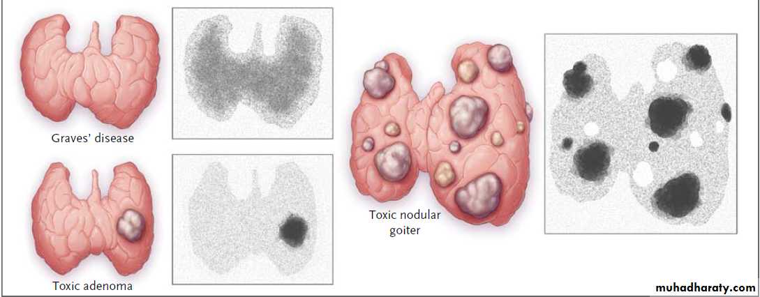 Endocrine