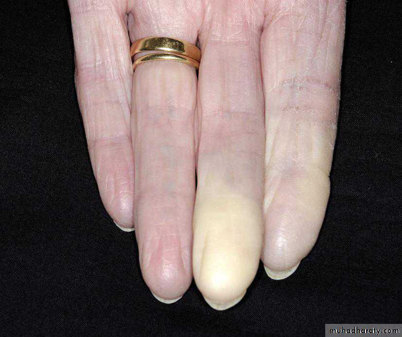 Rheumatology