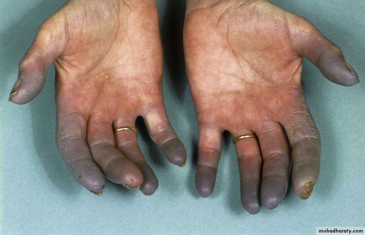 Rheumatology