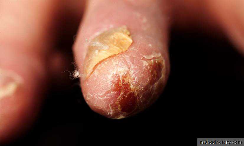 Rheumatology