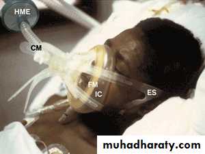 Rspiratory