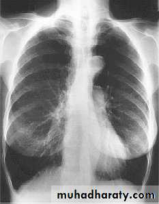 Rspiratory
