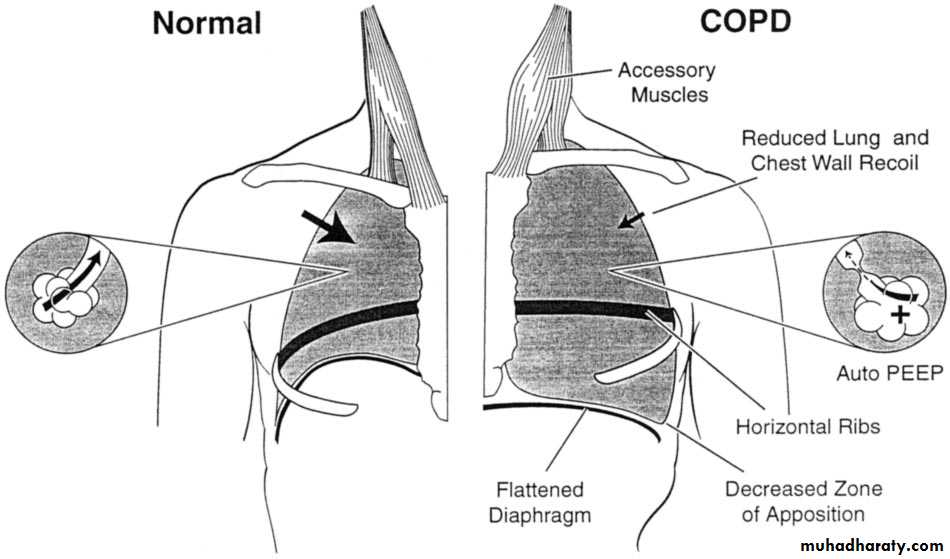 Rspiratory