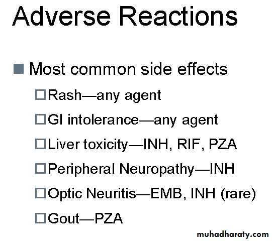 Tuberculosis