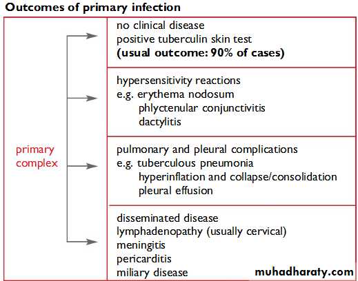Tuberculosis