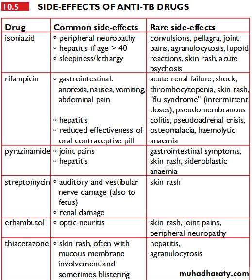 Tuberculosis