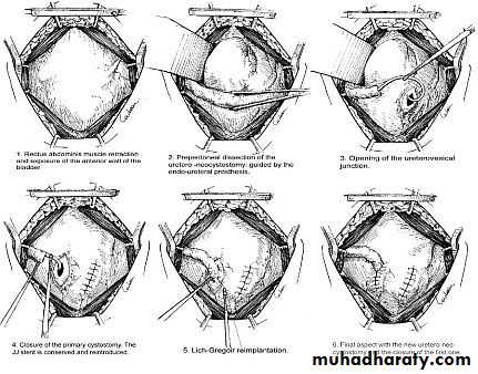 Urology