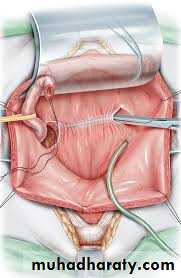 Urology