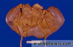 Urology
