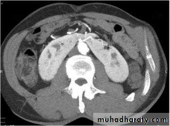 Urology