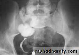 Urology