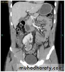 Urology