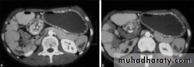 Urology
