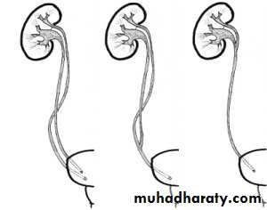 Urology