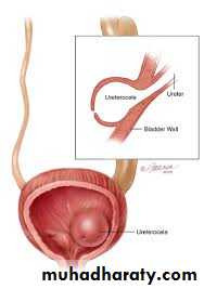 Urology