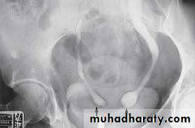 Urology