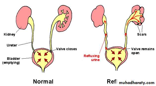Urology