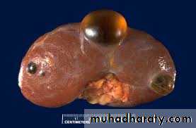 Urology
