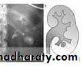 Urology