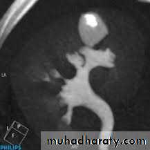 Urology