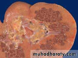 Urology
