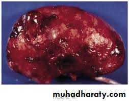 Urology