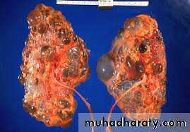 Urology