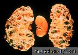Urology