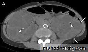 Urology