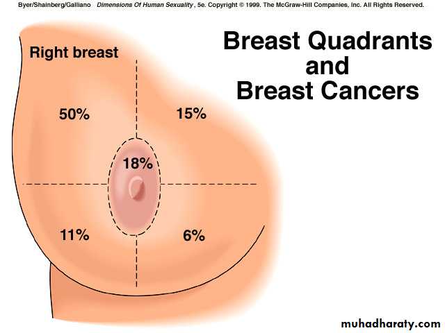 breast cancer