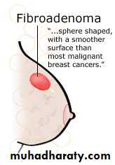 breast cancer