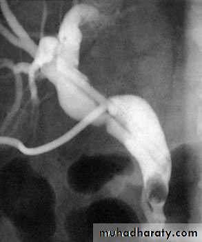 biliary