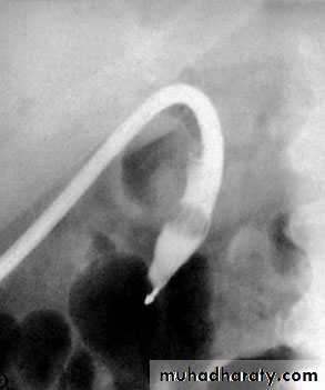 biliary