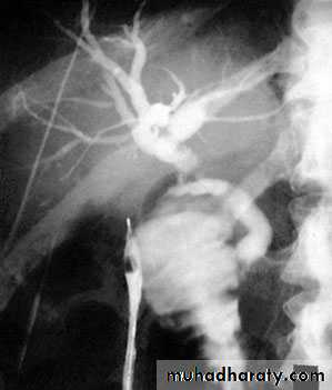 biliary