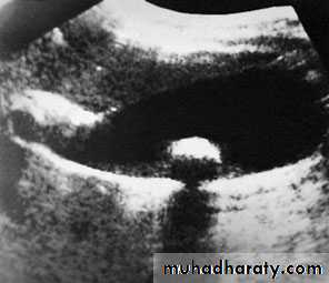 biliary