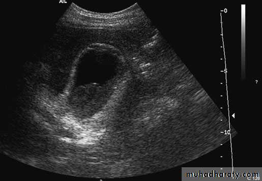 biliary
