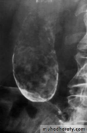 biliary
