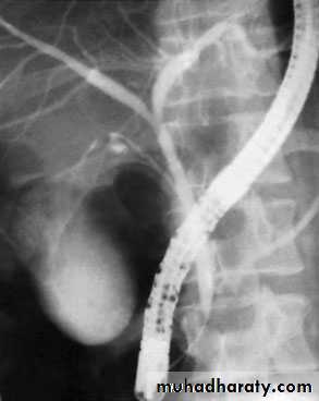 biliary