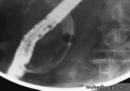 biliary