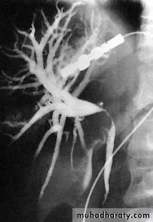 biliary