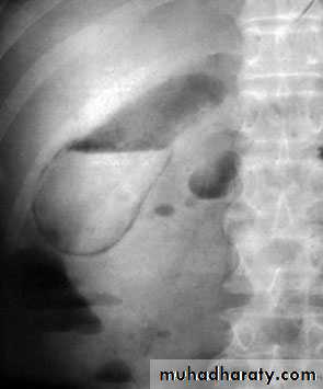 biliary