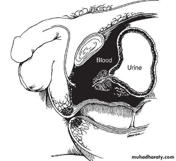 Urology