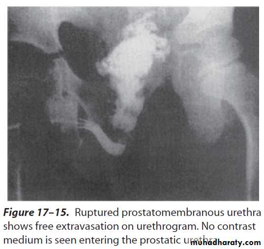 Urology