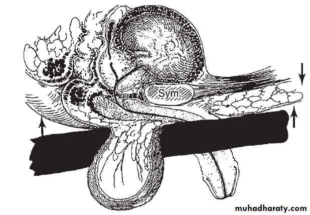 Urology