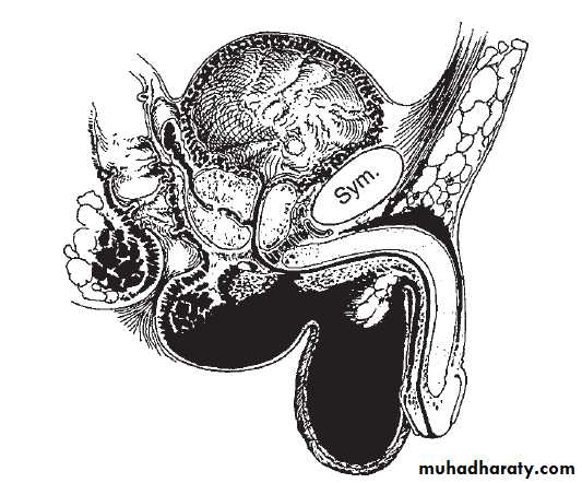 Urology