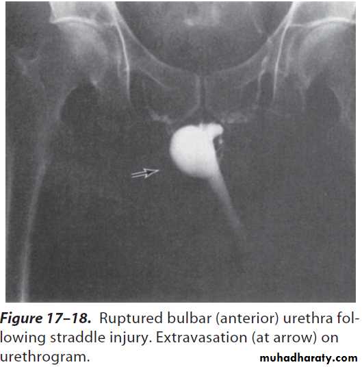 Urology