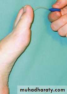 Diabetic foot