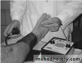Diabetic foot