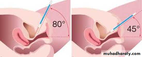 Urology
